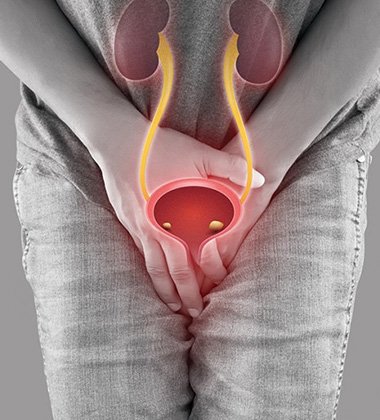 Cystolithotripsy Surgery