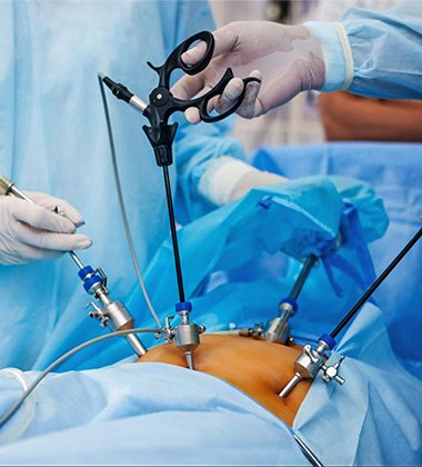 Laparoscopic Cholecystectomy