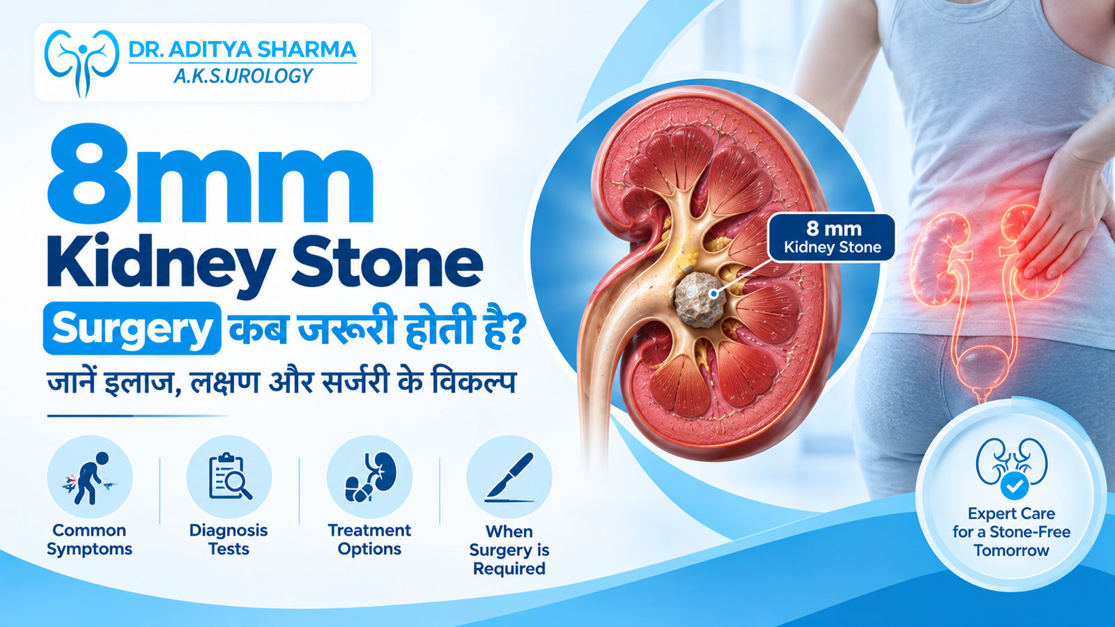 8mm Kidney Stone Surgery कब जरूरी होती है?
